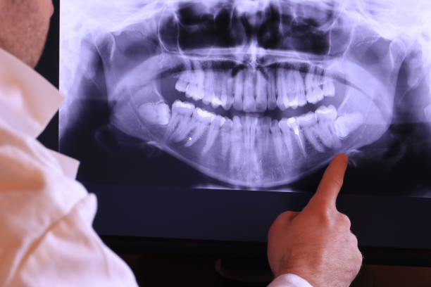 Best Emergency Dental Extractions in Hillsboro, OH