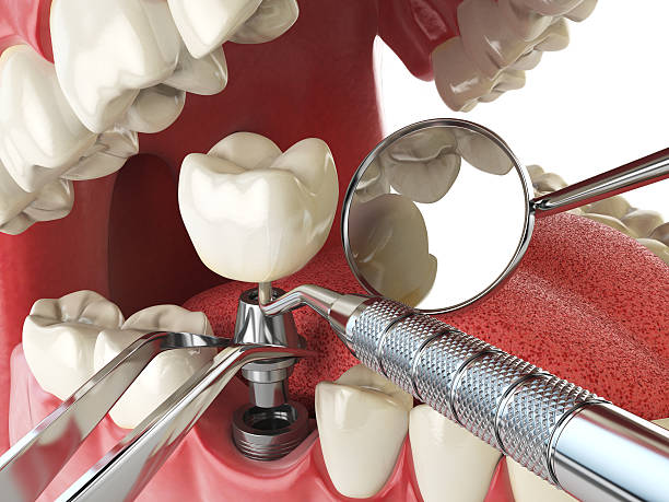 Best Broken or Cracked Tooth Emergency Dentist in Hillsboro, OH